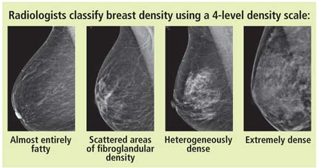 breast density scale